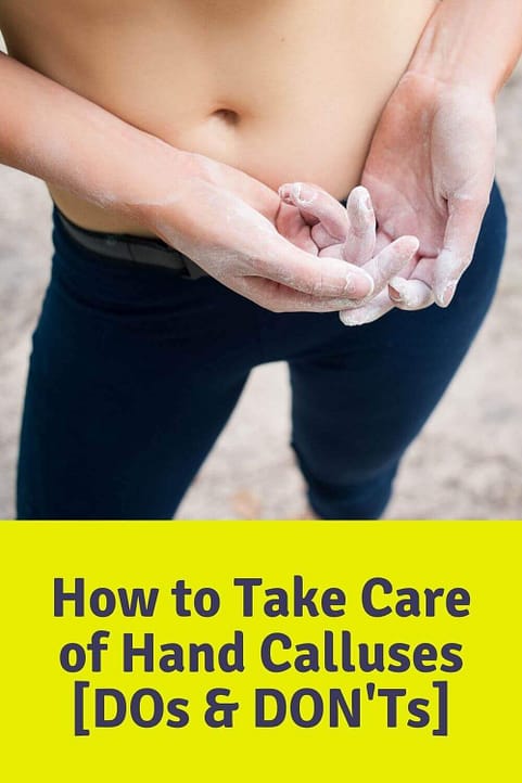 How to Take Care of Hand Calluses